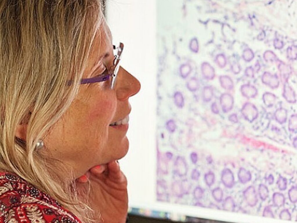 Aggressive Breast Cancers Store Large Amounts of Energy Enabling Them to Spread
